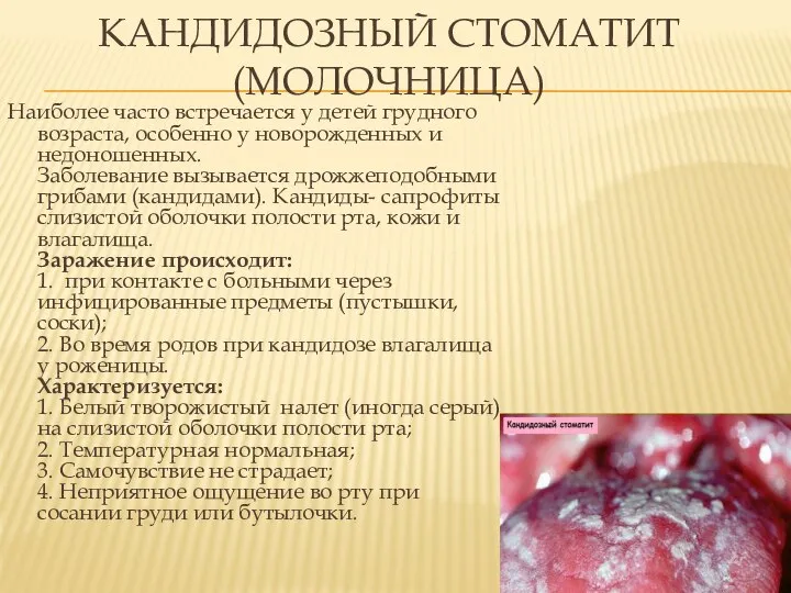 Наиболее часто встречается у детей грудного возраста, особенно у новорожденных и