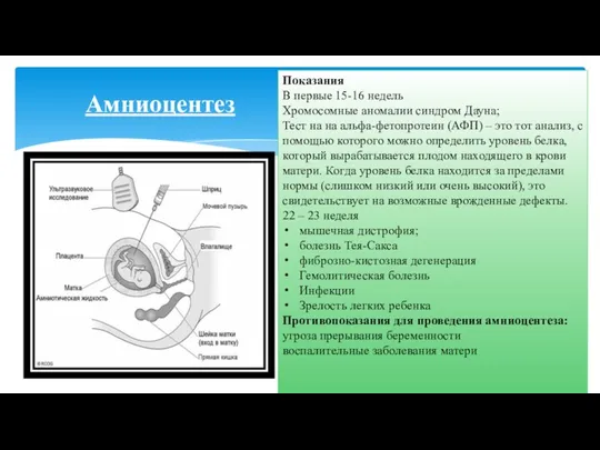 Амниоцентез Показания В первые 15-16 недель Хромосомные аномалии синдром Дауна; Тест
