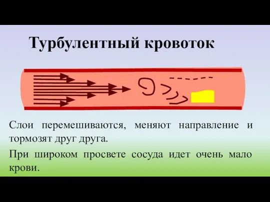 Турбулентный кровоток Слои перемешиваются, меняют направление и тормозят друг друга. При