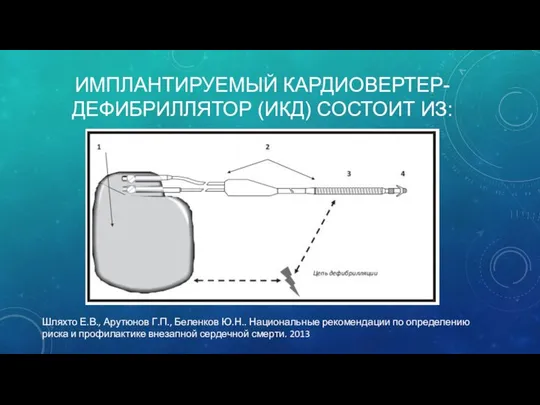 ИМПЛАНТИРУЕМЫЙ КАРДИОВЕРТЕР-ДЕФИБРИЛЛЯТОР (ИКД) СОСТОИТ ИЗ: Шляхто Е.В., Арутюнов Г.П., Беленков Ю.Н..