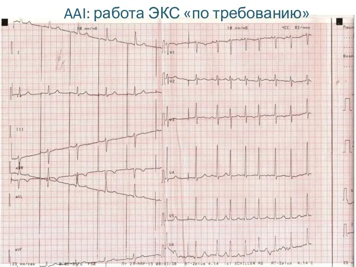 AAI: работа ЭКС «по требованию»