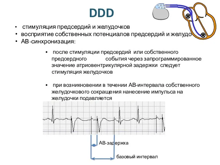 DDD стимуляция предсердий и желудочков восприятие собственных потенциалов предсердий и желудочков