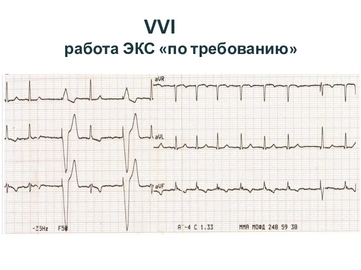 VVI работа ЭКС «по требованию»