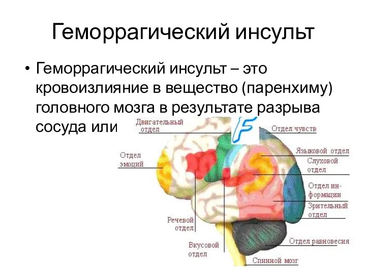 Геморрагический инсульт Геморрагический инсульт – это кровоизлияние в вещество (паренхиму) головного