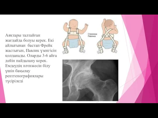 Аяқтары талтайған жағдайда болуы керек. Екі айлығынан бастап Фрейк жастығын, Павлик