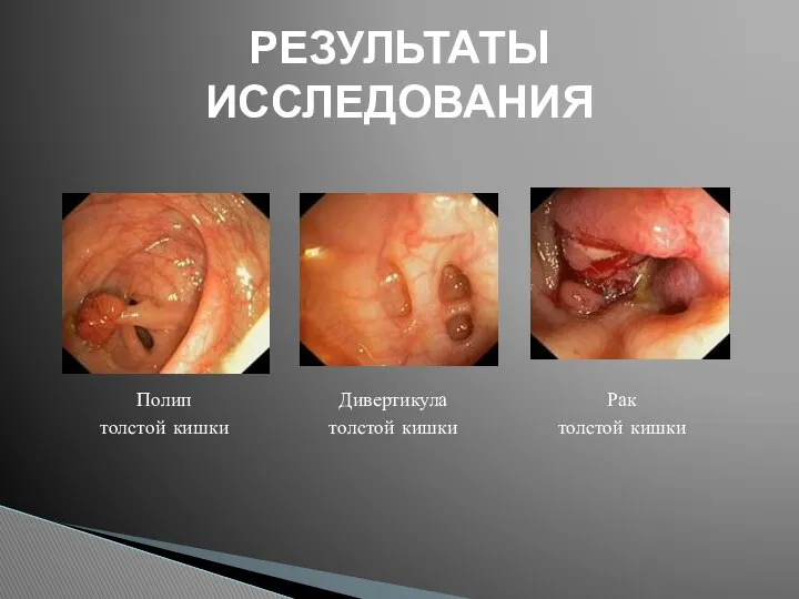 РЕЗУЛЬТАТЫ ИССЛЕДОВАНИЯ