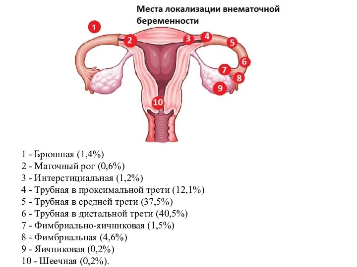 1 - Брюшная (1,4%) 2 - Маточный рог (0,6%) 3 -