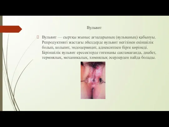 Вульвит Вульвит — сыртқы жыныс ағзаларының (вульваның) қабынуы. Репродуктивті жастағы әйелдерде