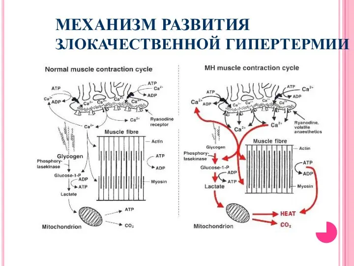 МЕХАНИЗМ РАЗВИТИЯ ЗЛОКАЧЕСТВЕННОЙ ГИПЕРТЕРМИИ