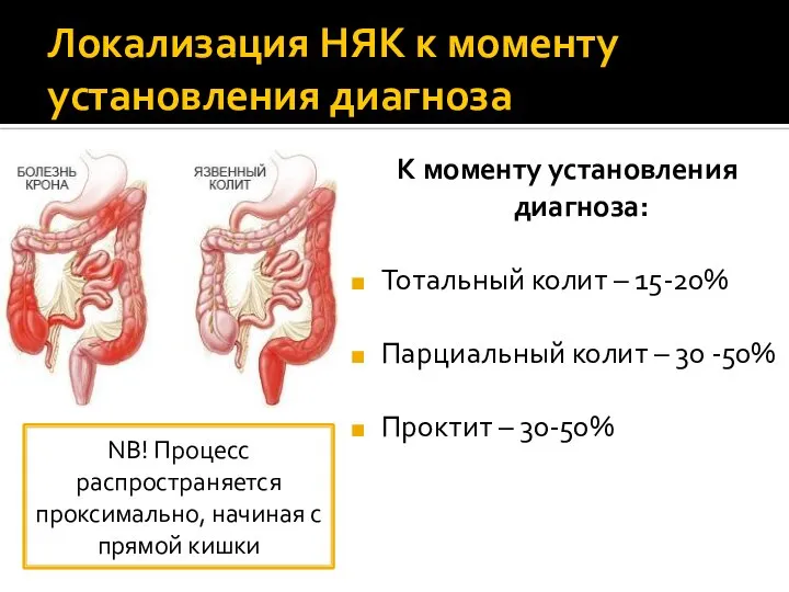 Локализация НЯК к моменту установления диагноза К моменту установления диагноза: Тотальный