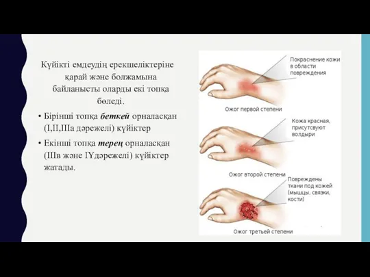 Күйікті емдеудің ерекшеліктеріне қарай және болжамына байланысты оларды екі топқа бөледі.