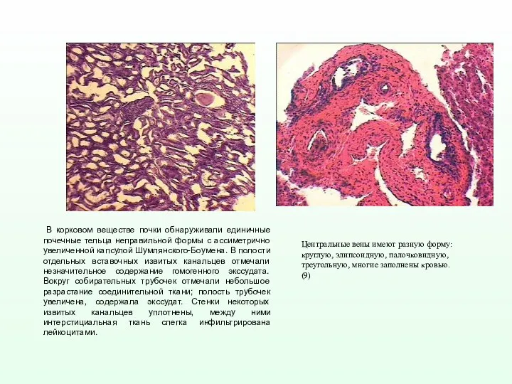 Центральные вены имеют разную форму: круглую, элипсоидную, палочковидную, треугольную, многие заполнены