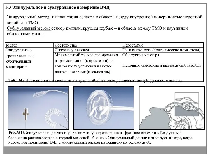 3.3 Эпидуральное и субдуральное измерение ВЧД Эпидуральный метод: имплантация сенсора в