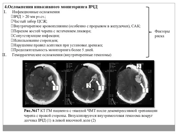 4.Осложнения инвазивного мониторинга ВЧД Инфекционные осложнения ВЧД > 20 мм рт.ст.;