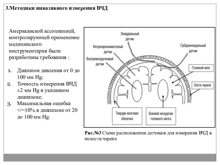 3.Методики инвазивного измерения ВЧД Рис.№3 Схема расположения датчиков для измерения ВЧД