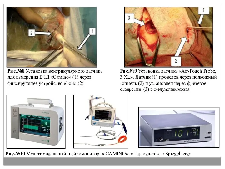 Рис.№10 Мультимодальный нейромонитор « CAMINO», «Liquoguard», « Spiegelberg» Рис.№8 Установка вентрикулярного