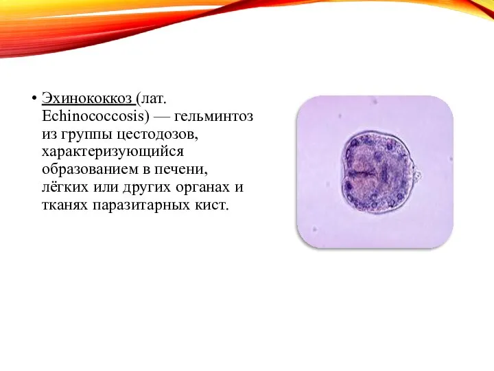 Эхинококкоз (лат. Echinococcosis) — гельминтоз из группы цестодозов, характеризующийся образованием в