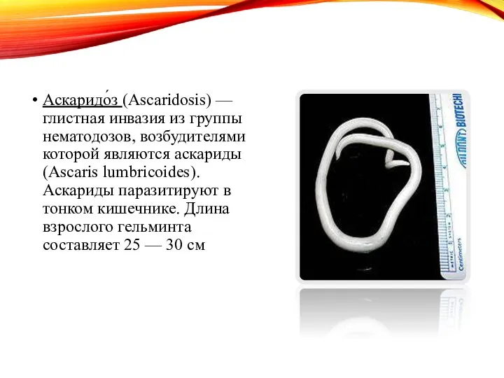 Аскаридо́з (Ascaridosis) — глистная инвазия из группы нематодозов, возбудителями которой являются