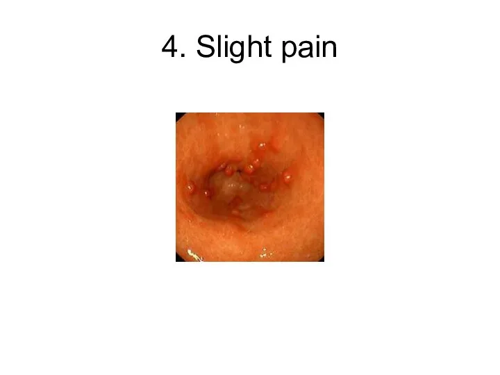 4. Slight pain