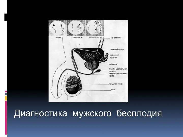 Диагностика мужского бесплодия