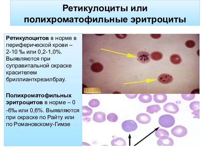 Ретикулоциты или полихроматофильные эритроциты Ретикулоцитов в норме в периферической крови –