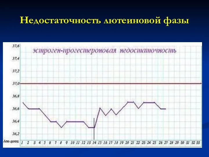 Недостаточность лютеиновой фазы