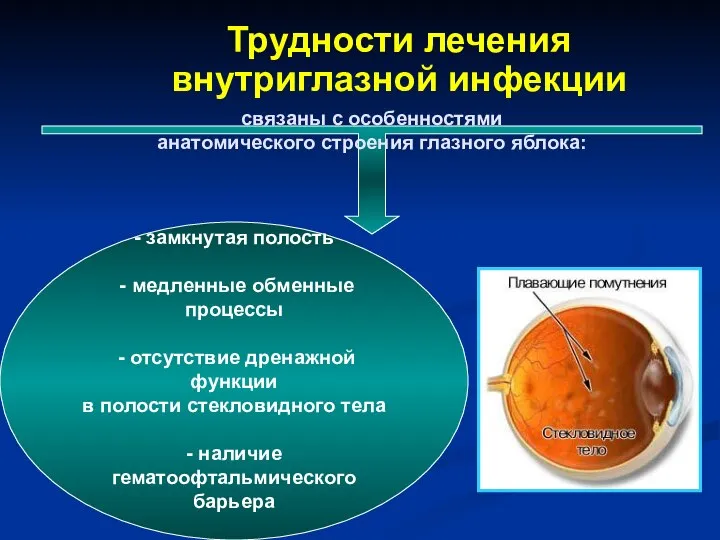 Трудности лечения внутриглазной инфекции связаны с особенностями анатомического строения глазного яблока: