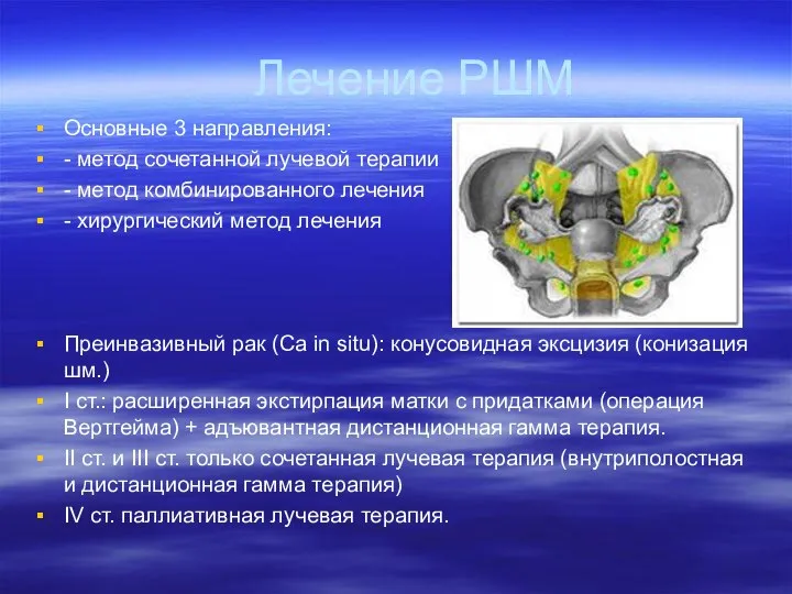 Лечение РШМ Основные 3 направления: - метод сочетанной лучевой терапии -