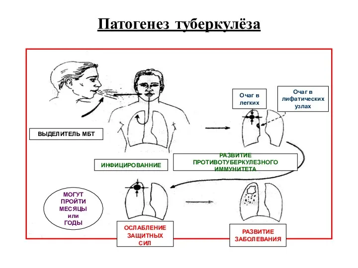 Патогенез туберкулёза ВЫДЕЛИТЕЛЬ МБТ ИНФИЦИРОВАННИЕ РАЗВИТИЕ ПРОТИВОТУБЕРКУЛЕЗНОГО ИММУНИТЕТА Очаг в лифатических