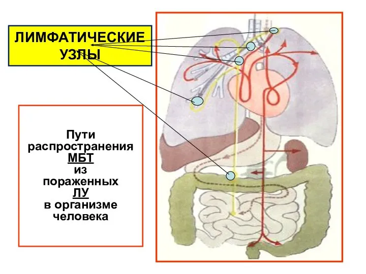 Пути распространения МБТ из пораженных ЛУ в организме человека ЛИМФАТИЧЕСКИЕ УЗЛЫ