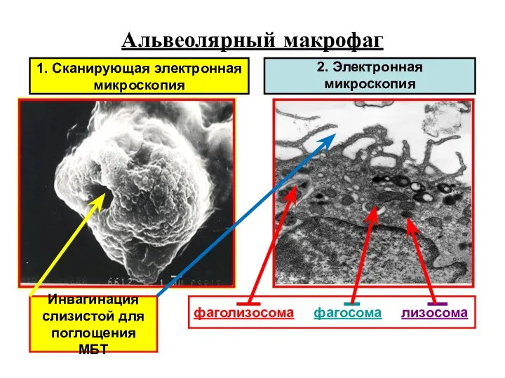 Альвеолярный макрофаг 2. Электронная микроскопия 1. Сканирующая электронная микроскопия фаголизосома фагосома