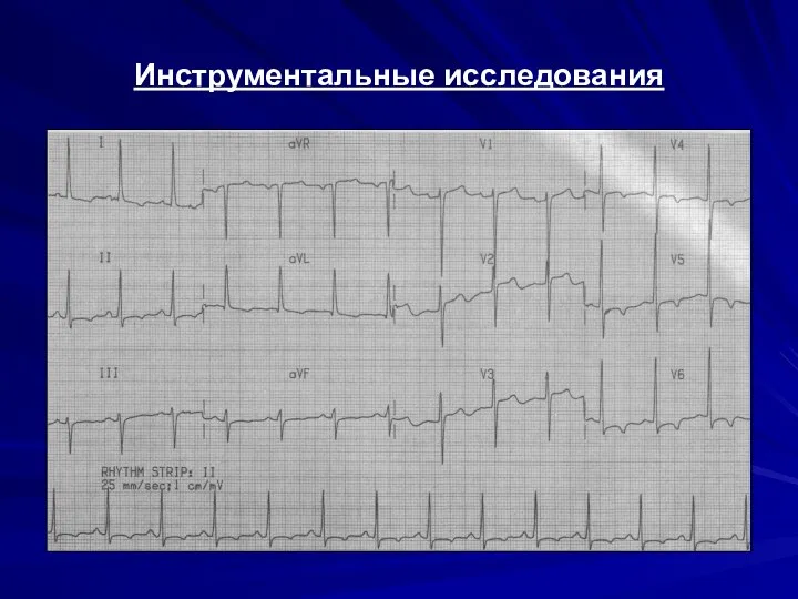 Инструментальные исследования