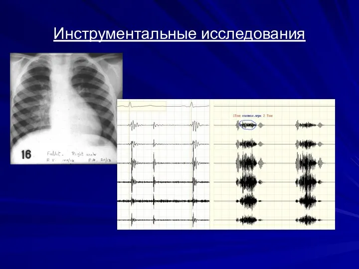 Инструментальные исследования