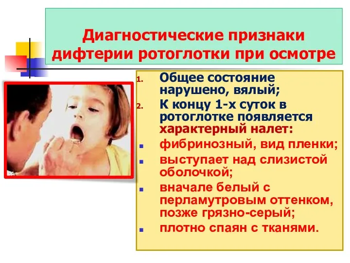 Диагностические признаки дифтерии ротоглотки при осмотре Общее состояние нарушено, вялый; К