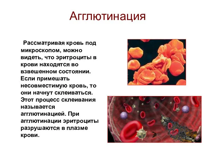 Агглютинация Рассматривая кровь под микроскопом, можно видеть, что эритроциты в крови