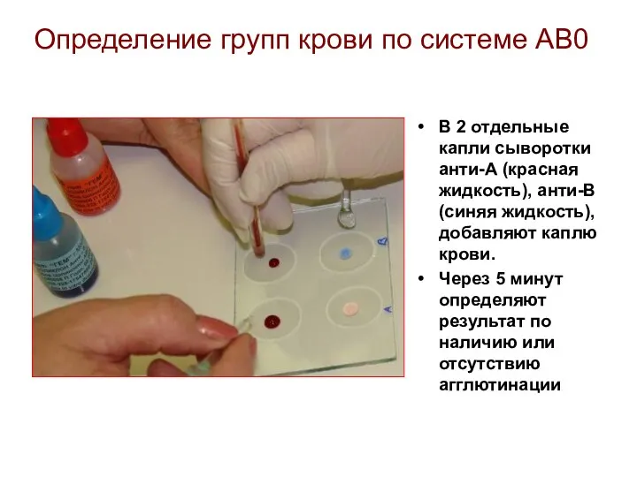 Определение групп крови по системе АВ0 В 2 отдельные капли сыворотки