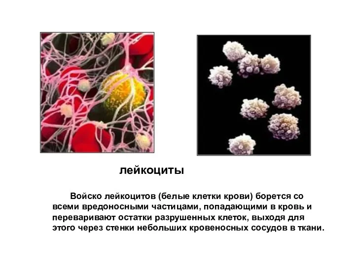 Войско лейкоцитов (белые клетки крови) борется со всеми вредоносными частицами, попадающими