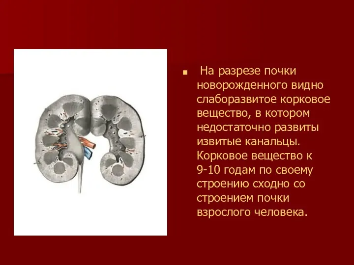 На разрезе почки новорожденного видно слаборазвитое корковое вещество, в котором недостаточно