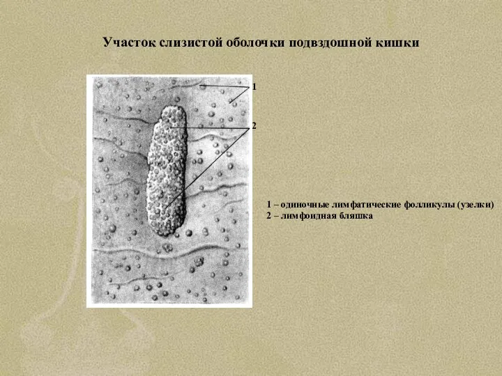 Участок слизистой оболочки подвздошной кишки 1 – одиночные лимфатические фолликулы (узелки)