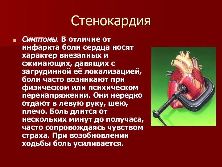 Стенокардия Симптомы. В отличие от инфаркта боли сердца носят характер внезапных