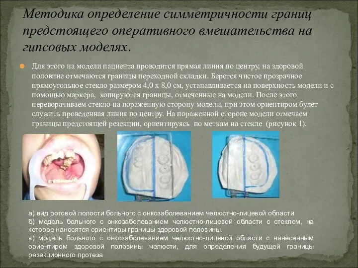 Для этого на модели пациента проводится прямая линия по центру, на