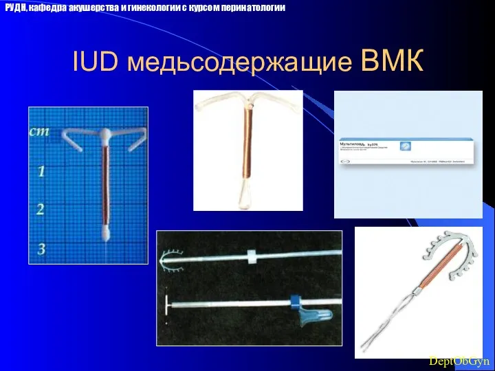 IUD медьсодержащие ВМК РУДН, кафедра акушерства и гинекологии с курсом перинатологии DeptObGyn