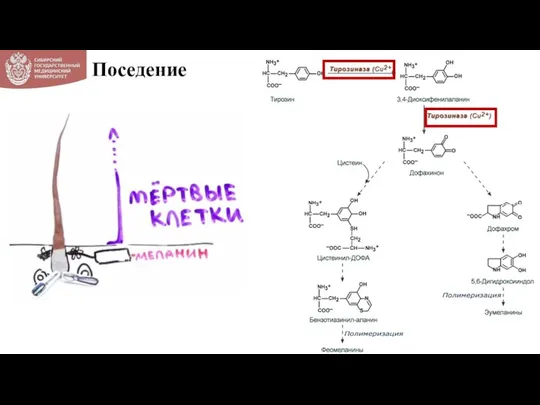 Поседение