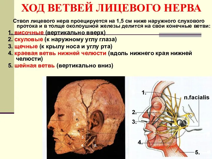 ХОД ВЕТВЕЙ ЛИЦЕВОГО НЕРВА Ствол лицевого нерв проецируется на 1,5 см