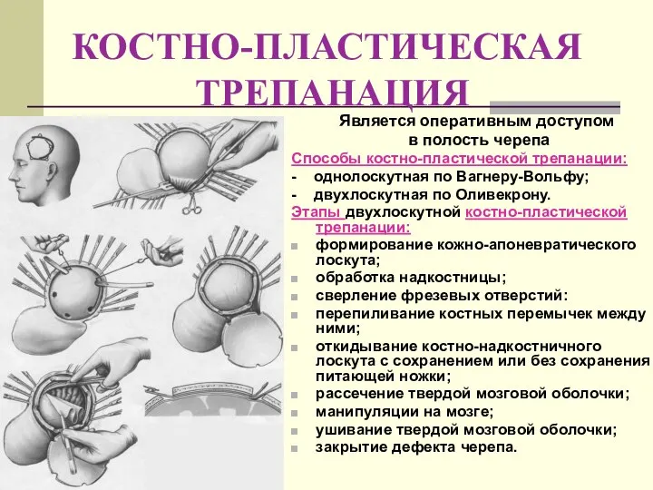 КОСТНО-ПЛАСТИЧЕСКАЯ ТРЕПАНАЦИЯ Является оперативным доступом в полость черепа Способы костно-пластической трепанации: