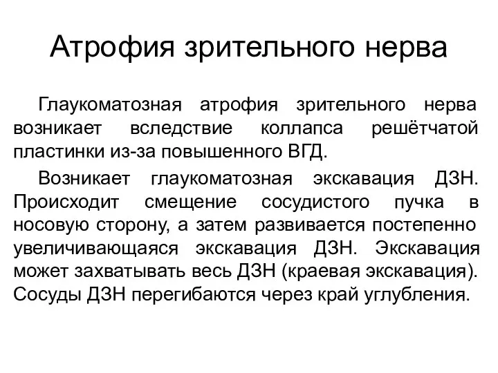 Атрофия зрительного нерва Глаукоматозная атрофия зрительного нерва возникает вследствие коллапса решётчатой