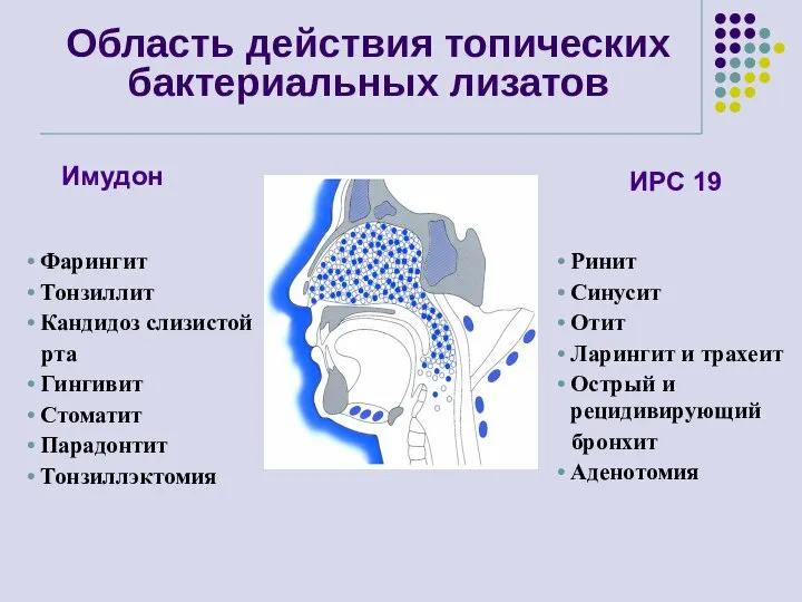 Ринит Синусит Отит Ларингит и трахеит Острый и рецидивирующий бронхит Аденотомия