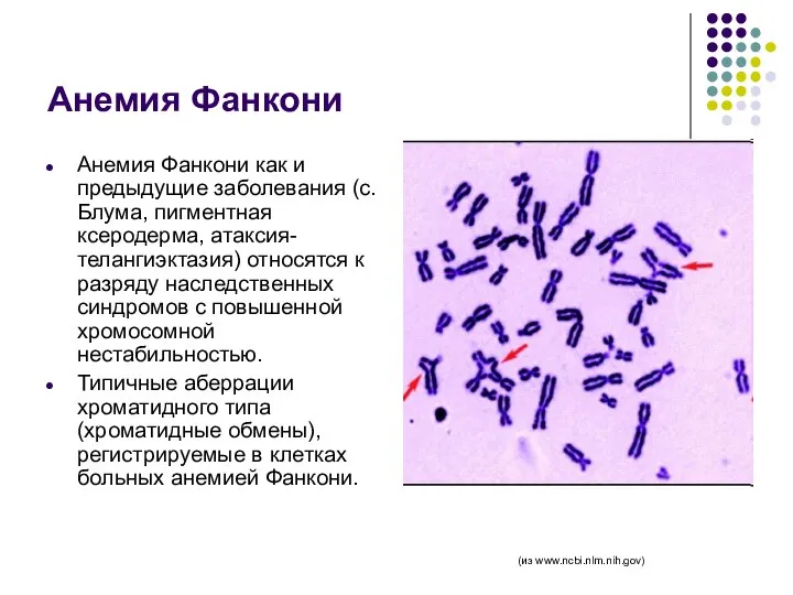 Анемия Фанкони Анемия Фанкони как и предыдущие заболевания (с. Блума, пигментная