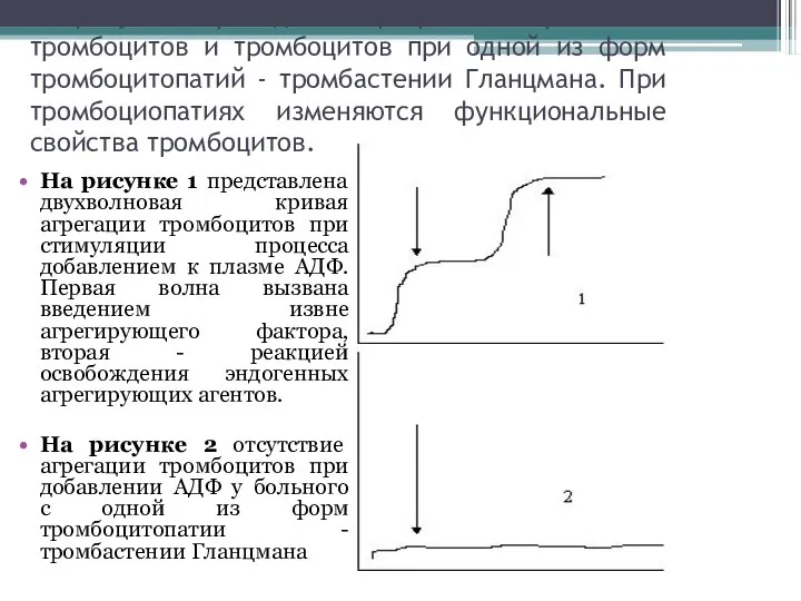 На рисунках приведены агреграммы нормальных тромбоцитов и тромбоцитов при одной из