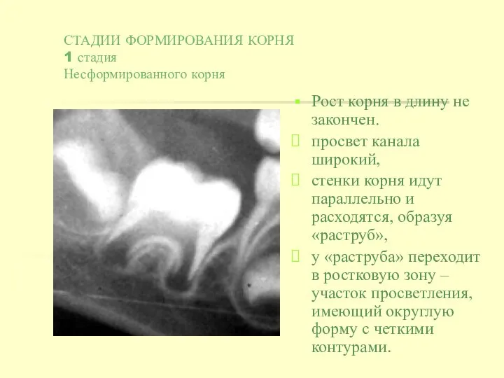 СТАДИИ ФОРМИРОВАНИЯ КОРНЯ 1 стадия Несформированного корня Рост корня в длину